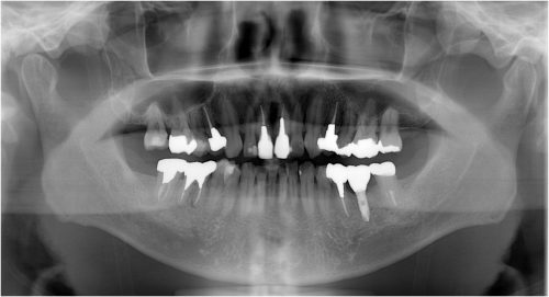 %e7%ae%b1%e5%b4%8e%e3%80%80%e8%a3%9c%e7%b6%b4%e5%be%8c%e3%80%80